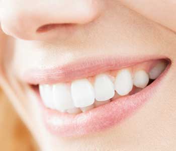 healthy smile, AZ Dental Wellness