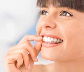 At AZ Dental Wellness of Scottsdale, we believe that all our patients should benefit from a beautiful, straight smile.