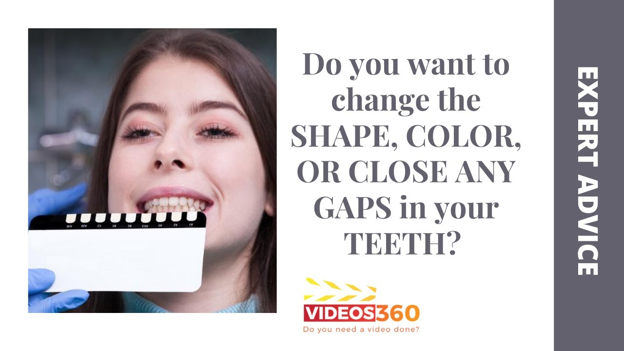 Porcelain veneers at AZ Dental Wellness explained by Dr. Rogel Carlos