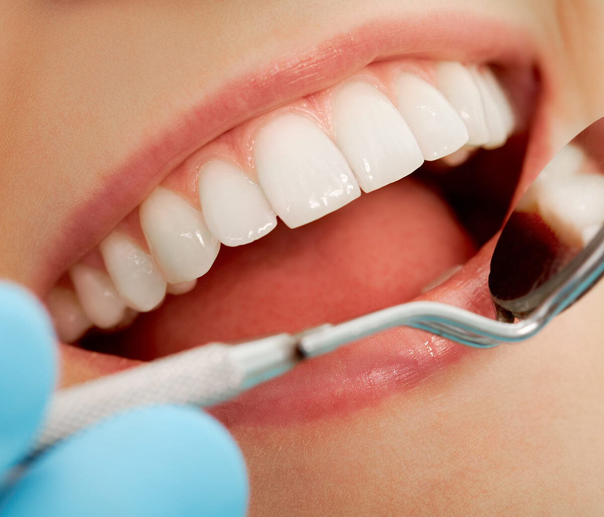 In Scottsdale, AZ Area Patients Ask, Can Veneers Fix Crooked Teeth?