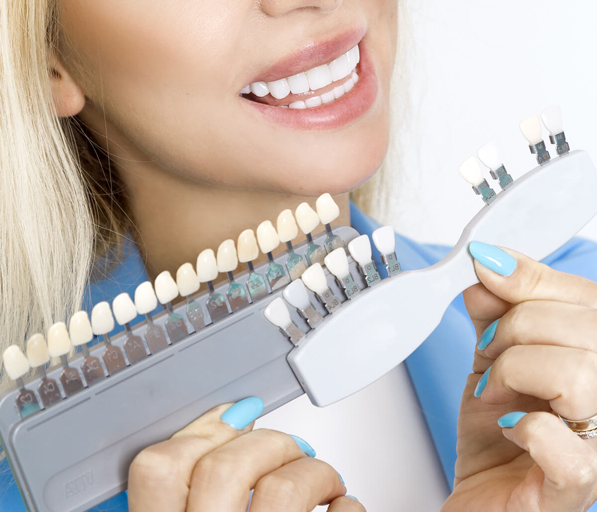 Porcelain Teeth Veneers in Scottsdale Arizona Area